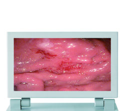 Huger Integrert monitor 12"