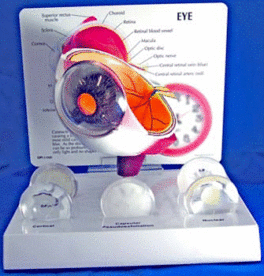 Modell, øye, katarakt